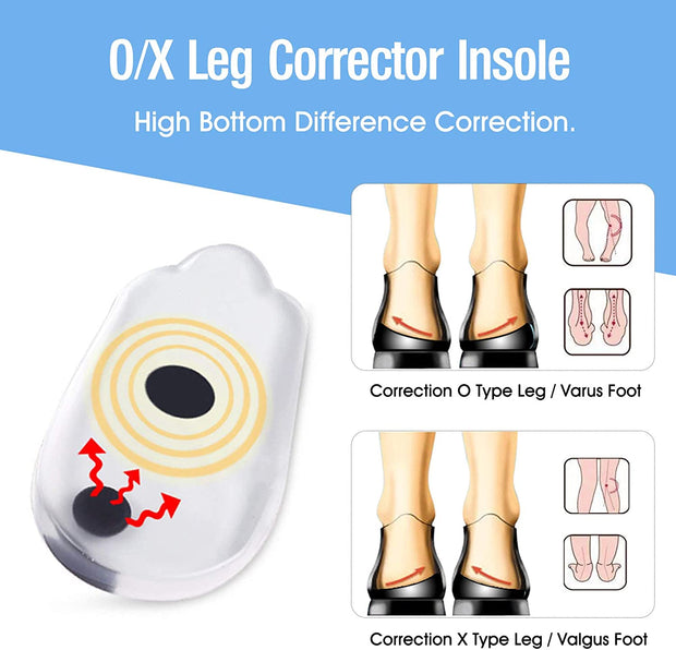 Unisex Insole Correction Shoe Inserts Straightening Pads