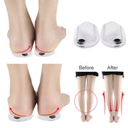 Unisex Insole Correction Shoe Inserts Straightening Pads