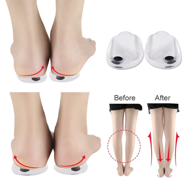 Unisex Insole Correction Shoe Inserts Straightening Pads